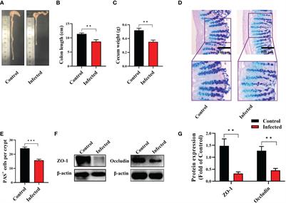 The non-oral infection of larval Echinococcus granulosus induces immune and metabolic reprogramming in the colon of mice